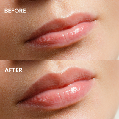 Mia Plumping lip gloss - 11 Lolita